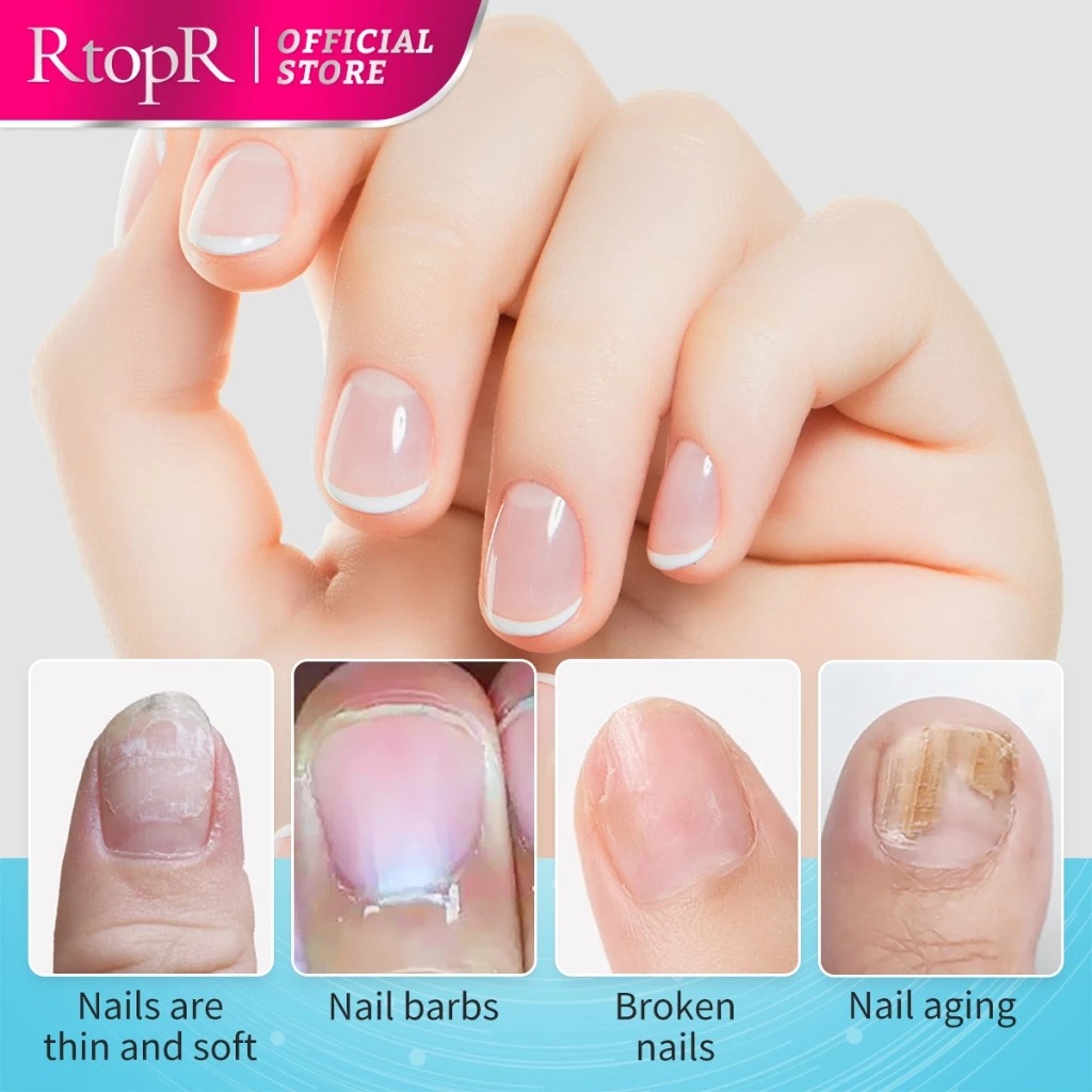 Ilustrasi Masalah Kuku