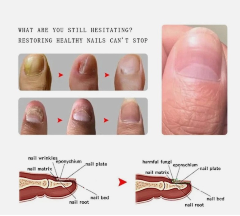 Testimoni Sebelum Selepas 3