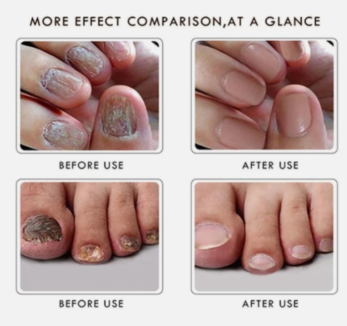 Testimoni Sebelum Selepas 1